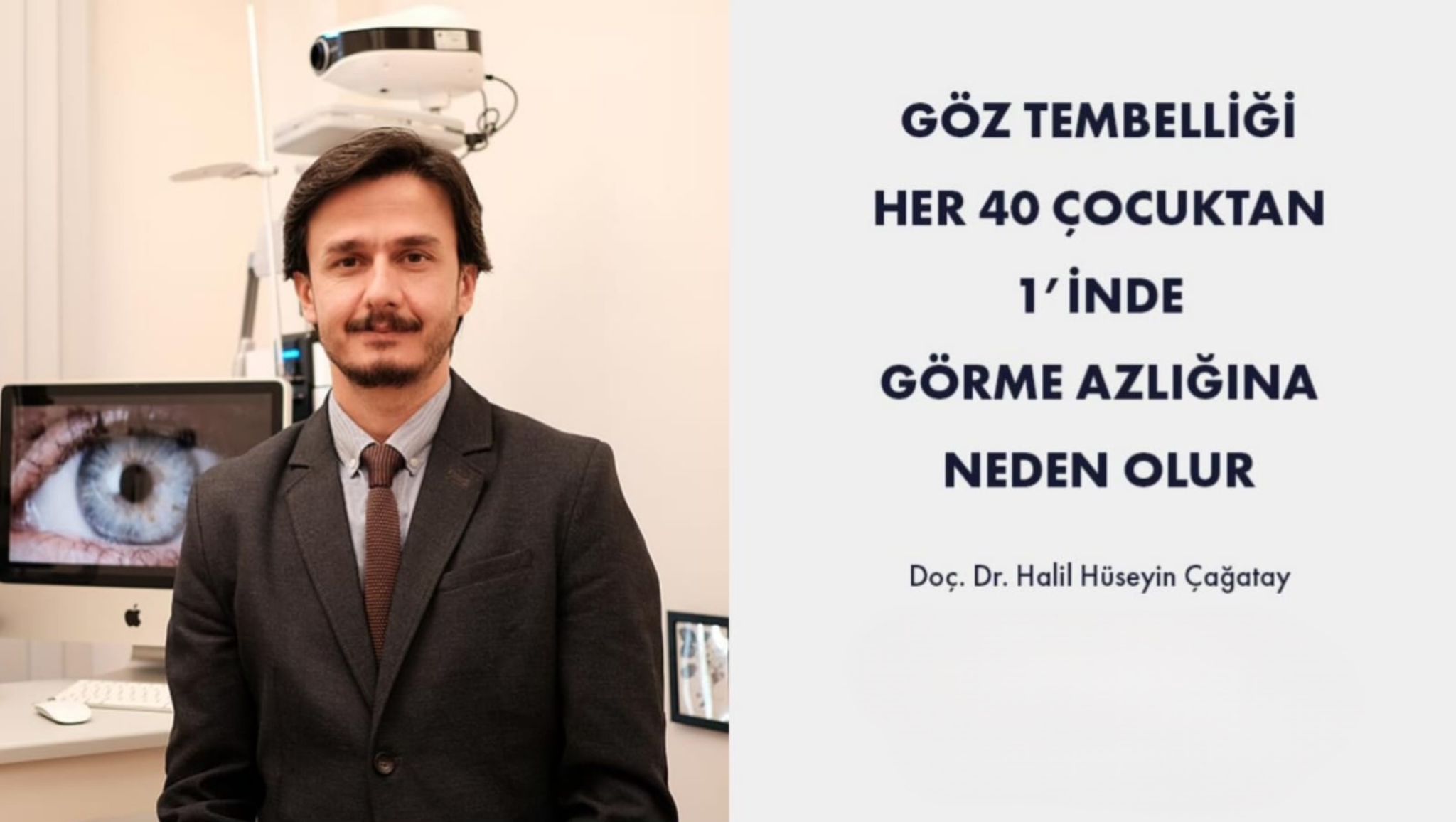 gÃ¶z tembelliÄi